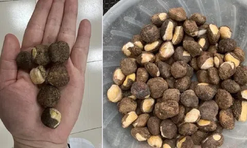 Lạng Sơn: Ăn loại hạt có hình dáng giống hạt dẻ, gần 20 người nhập viện